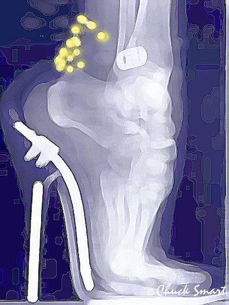 X-ray
